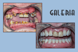 Stomatologiczne metamorfozy 13