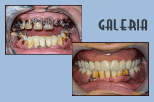 Stomatologiczne metamorfozy 14