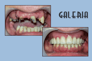 Stomatologiczne metamorfozy 15